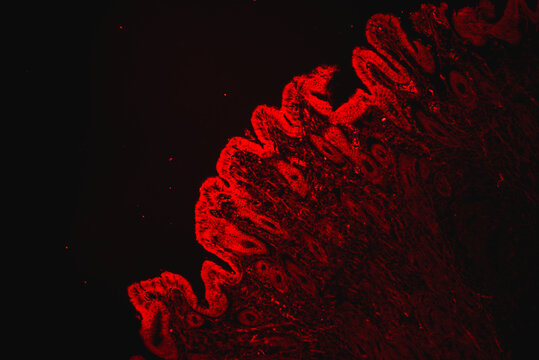 human stomach gastric mucosa intestinal metaplasia