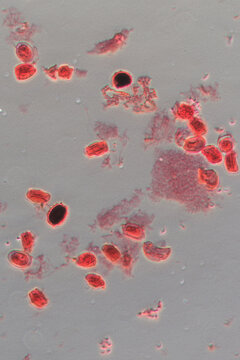 eggs of blood flukes, micrograph.