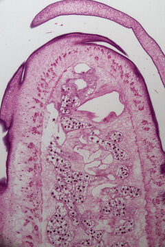 Tapeworm, Taenia Pisiformism