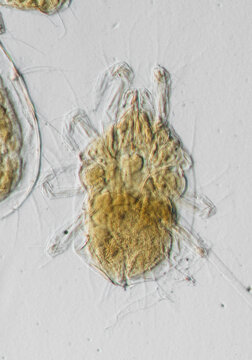 peach pest mite worm, micrograph