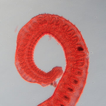 worm larva, micrograph.