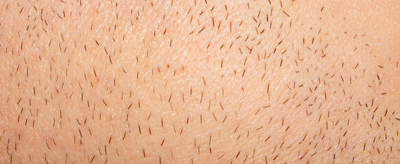 Unshaven stubble on a man's face.Part of an unshaven male face.Photo of male bristles.