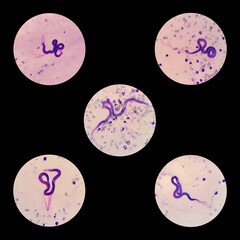 Microfilariae are sheathed in the blood smear of a dog. Light microscope of Brugia spp.
