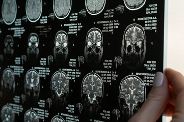 Close-up of magnetic resonance imaging of the human brain