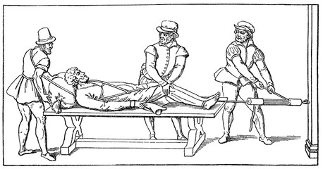 Establishment of the dislocated thigh in the time of Ambrosius Pare (French barber surgeon, 1510-1590). Illustration of the 19th century. Germany. White background.