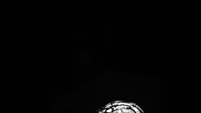 Brain Mr. Healthcare Concept. Magnetic Resonance Imaging of Human Brain. Checking Cranium. Scanning of Man Head. MRI.