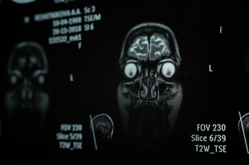 Close-up of magnetic resonance imaging of the human brain
