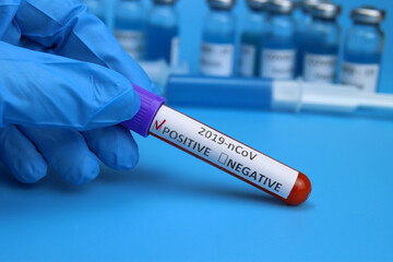 Obraz premium Doctor, nurse keep positive blood test for coronavirus