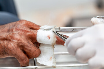 Wound fingers are being treated.