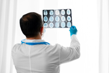 Senior man doctor in mask examines head MRI in hospital