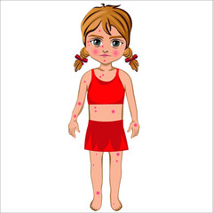 The girl's skin itches. Girl with Itches itchy blisters symptom ill with measles chicken pox pimples. Vector illustration
