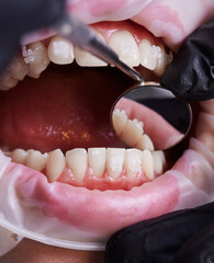 Dentist checking patient's lower teeth with a help of mirror. Close up view to beautiful white...