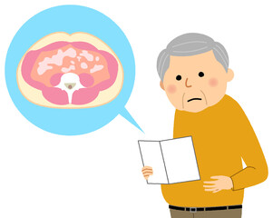 内臓脂肪型肥満の高齢者