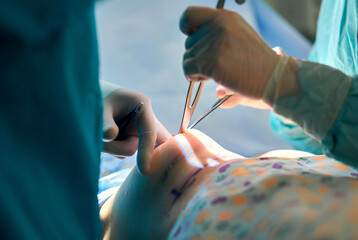 surgeon performs the operation in the operating room