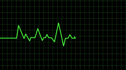 heart beat on monitor