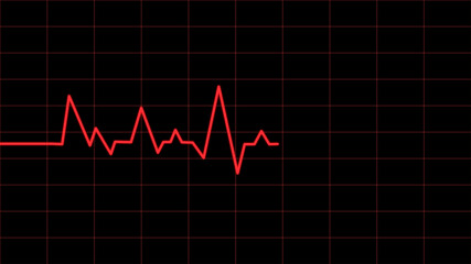 heart beat on monitor