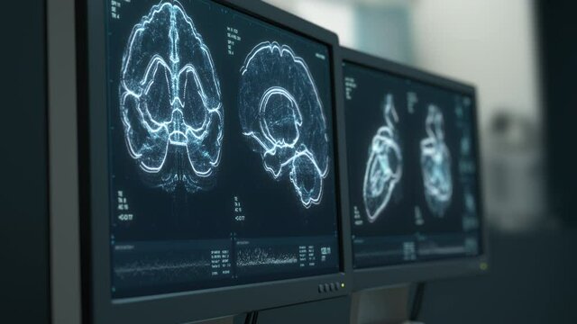 Heart and brain scanning data displayed on hospital monitors. Magnetic resonance, MRI. Disease diagnostics. Special medical equipment. ECG, CT. Computer tomography. Neurology, cardiology research. 3D