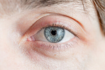 light gray-blue eye looks directly into the lens. Close-up