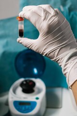 Veterinarian analyzing blood