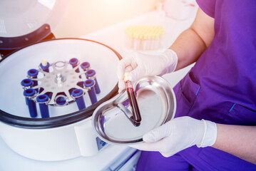 Platelet-Rich plasma preparation. Tube with blood in hands