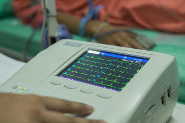 Electrocardiogram in the hospital, analyzing ECG electrocardiogram of patient in hospital.