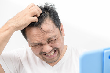 A middle-aged man scratch his hair on the scalp isolated on white