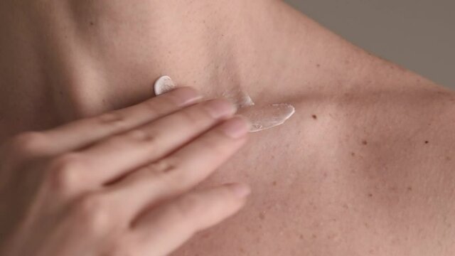 Woman applying treatment cream on surgery scar on her collarbone