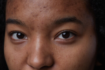 Extreme close up portrait of real African American woman looking at camera with focus on skin...