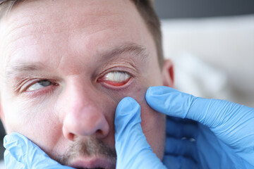 An ophthalmologist examines the patient's eye closeup