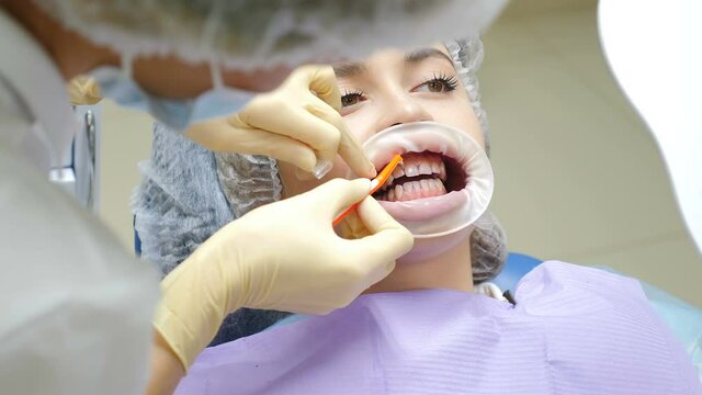 Professional dental hygiene procedure in dentistry. Doctor marking teeth. Modern stomatology. professional teeth scaling. Female patient in dental chair at dentist. teeth cleaning, 4 k video