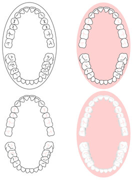 正しいきれいな歯並びを上から見た図セット