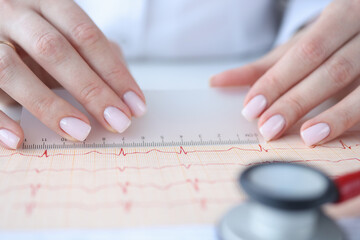 Doctor cardiologist examining electrocardiogram with ruler closeup