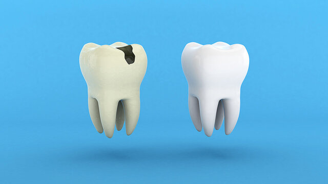 Bad tooth. A tooth with a crease and a hole and a healthy white tooth. 3d render