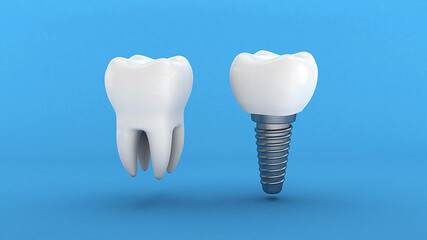 Dental implant. White tooth and implant on a blue background. 3d render