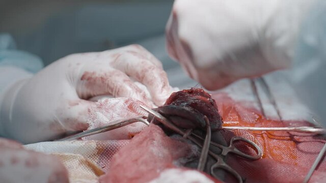 Surgeons cutting flesh. Action. Close-up of surgical intervention in male genital organ. Bloody penis enlargement surgery