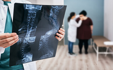 Doctor holds an x-ray of a cervical spine over background osteopath check-up overweight woman's spine. Scoliosis of spine, diagnosis