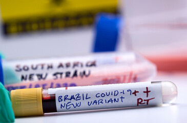 Fototapeta premium Several vials of blood samples positive for covid-19 infection of the new variant in the Brazil, conceptual image.