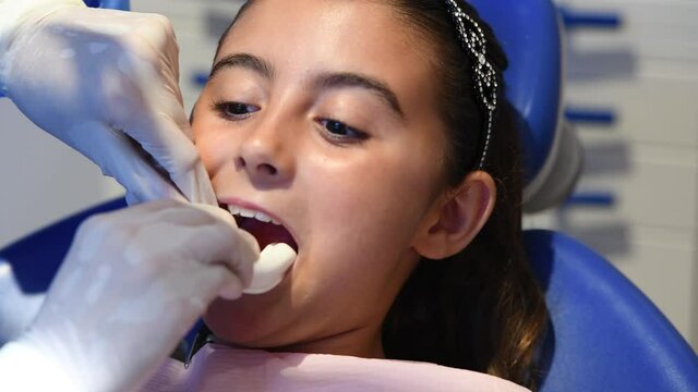 Dentist applying fluorine paste to young girl teeth during dental cleaning. Slow motion