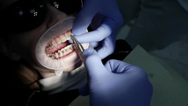 A patient with a mouth dilator in a dental chair, braces on his teeth, a doctor performs various procedures with the help of dental instruments.