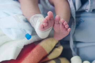 newborn baby's leg wrapped in a cotton swab and a needle for medication.