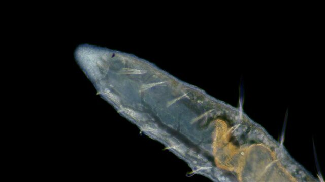 worm Nais sp. under a microscope, Family Naididae, a class of Oligochaeta, feed on plant foods (algae) and the remains of dead organisms, sometimes protozoa.Volga River