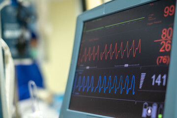 EKG monitor in intra aortic balloon pump machine. Medical equipment.