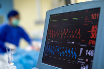 EKG monitor in intra aortic balloon pump machine. Medical equipment. - obrazy, fototapety, plakaty