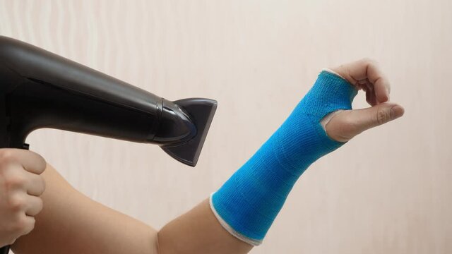 Male hand wrapped in fiberglass plaster cast dries with a hairdryer. Broken wrist in a modern waterproof bandage