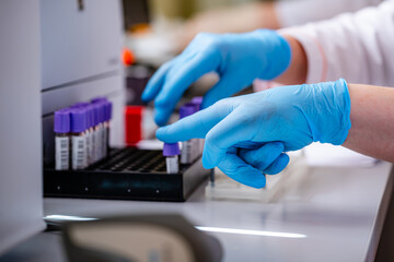 Technician placing blood tubes in the laboratory centrifuge. Selective focus on hands in blue latex...