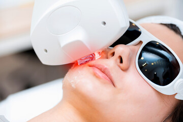 Treatment of problem skin in the beauty parlor. Elos rejuvenation and pigmentation removal close-up