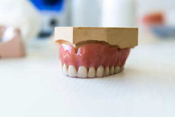 Complete denture on the table in a dental laboratory