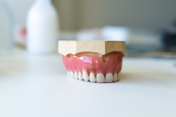 Complete denture on the table in a dental laboratory