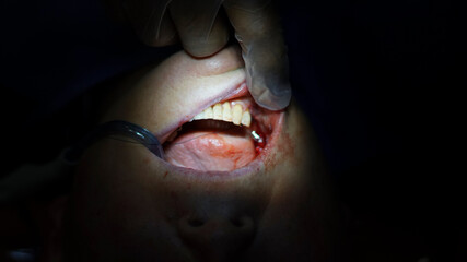 Las increíbles fotos de odontología de Juan Vélez