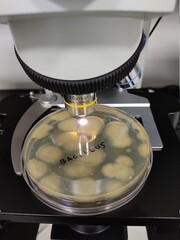 Microscopic observation of microbial culture results